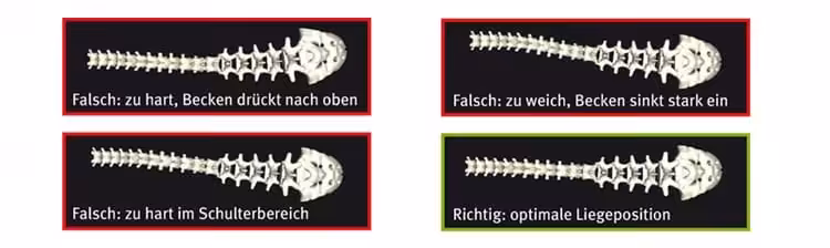 vergleich-richtig-liegen-matratze-bettenhaus-schlafoase-nuernberg Sicherer Matratzenkauf mit dem WIRBELSCANNER ® | Bettenhaus Schlafoase